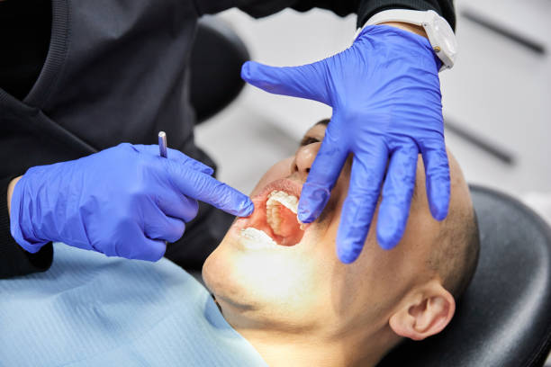 Best Emergency Root Canal Treatment in Hamlet, NC